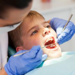 Cavities in Children: What to do?